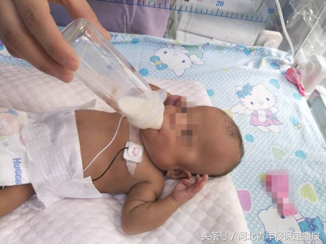 保定新生婴儿出生,生长受限的早产儿刚出生的照片