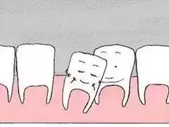 五十牙齿松动什么原因,牙齿松动的4个原因