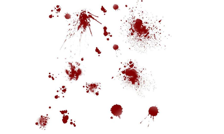 意外暴露乙肝病毒后如何预防感染,意外接触丙型肝炎病毒的处理方法