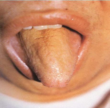 蒲辅周讲舌诊,蒲辅周怎么看舌诊