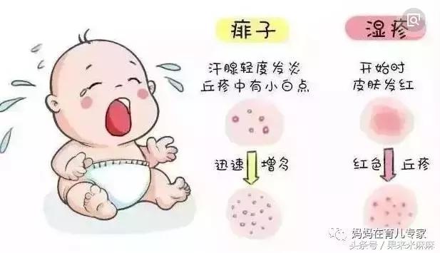 宝宝冬天长痱子怎么快速消除,一年四季都有痱子怎么办