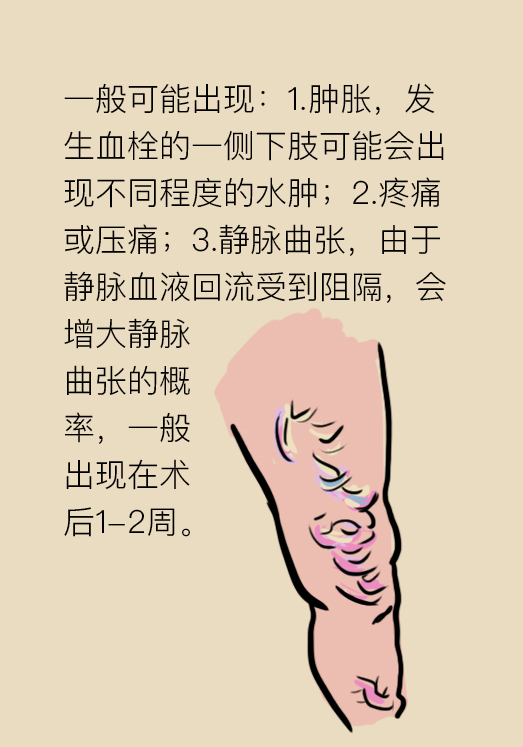 压力袜穿久了没脱,压力袜穿起来很紧还能穿吗