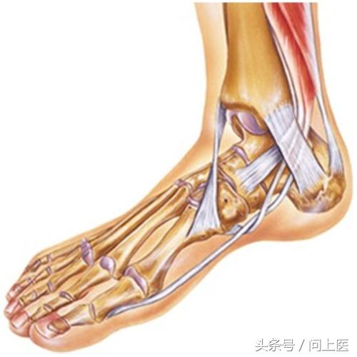 大脚趾关节炎怎么才能好,脚拇指关节炎症状有哪些表现