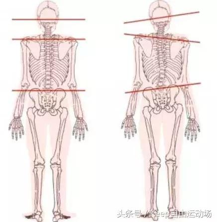 「气质杀手」毁一生，2个动作拯救你的高低肩！