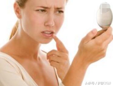 嘴唇周围长痘吃什么最好,鼻子嘴唇周围长痘痘是什么原因