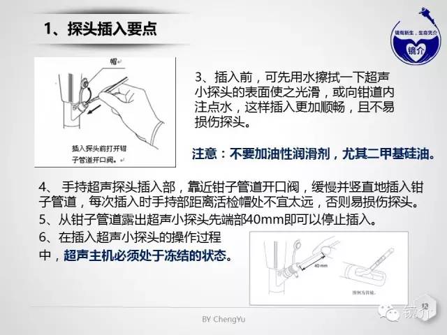 内镜超声小探头设定、使用、维护要点分析