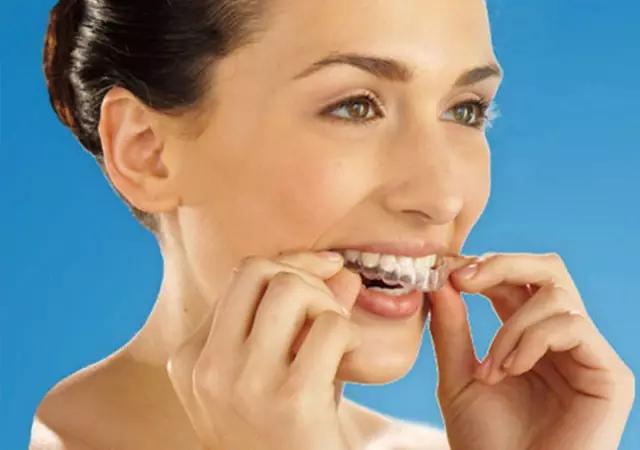 美容冠美牙效果,7天快速矫正靠谱吗