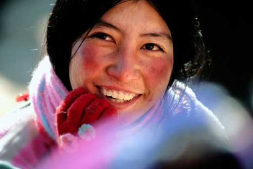 怎样能彻底去除面部红血丝,如何祛除面部红血丝