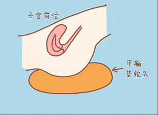 想备孕二胎需要做啥检查呢,想备孕重视这三件事