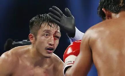 邹市明病情初步确诊，竟然这么严重：完全恢复不可能，还有后遗症