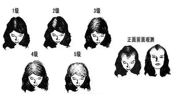 洗发水里面有害成分有哪些,洗发水里有什么成分会导致过敏