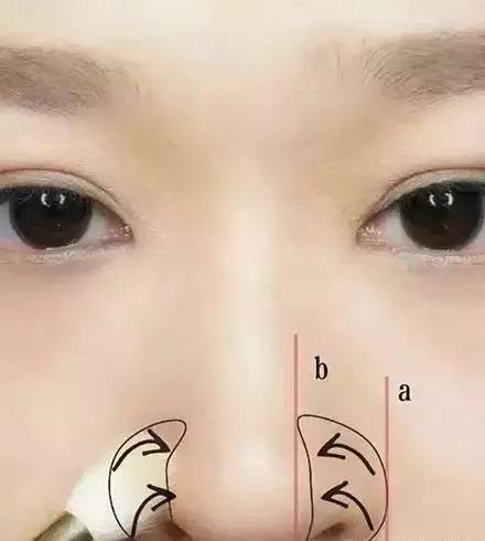 杨幂、唐嫣、神仙姐姐的鼻子原来是这样“整的”！