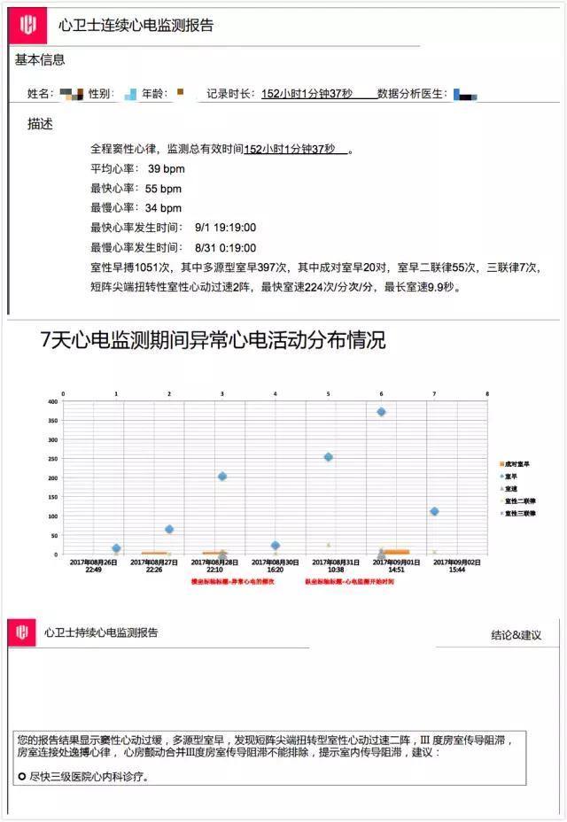 喝酒引起房颤戒酒后恢复吗,喝酒引起的房颤把酒戒了会好吗