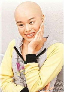 女明星没了刘海变好看了,女明星突然没头发了