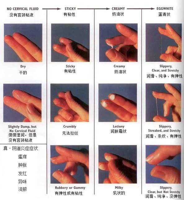 白带应该是什么样的才正常,什么样的白带才是正常的呢