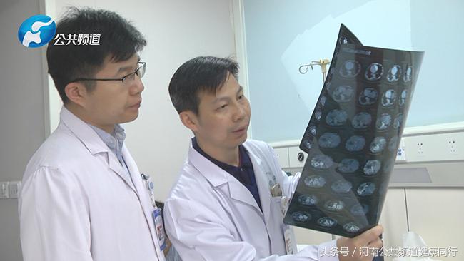 郑大一附院余祖江专家怎么样挂号,郑州郑大一附院余祖江医生怎么样