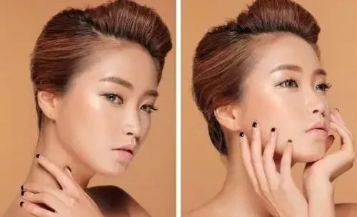 鼻子很矮不动手术怎么改善,怎么修鼻子立体不塌鼻