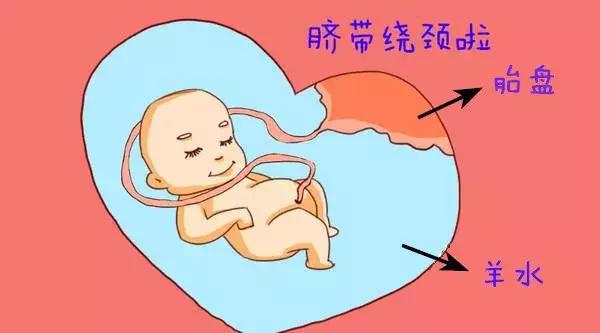 产检b超单怎么看,产检b超单上有哪些数据