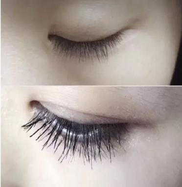 西双版纳哪里买泰国护肤品,去泰国必买祛痘护肤品