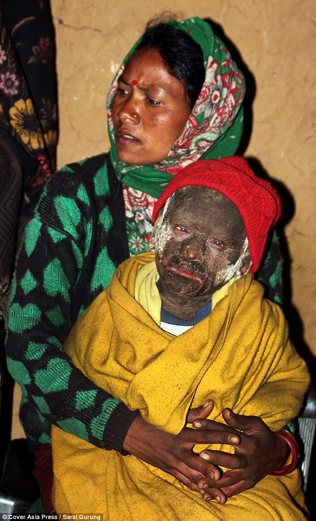 小男孩一出生就得到了一种怪病,男孩从小智力有残缺长大后被孤立