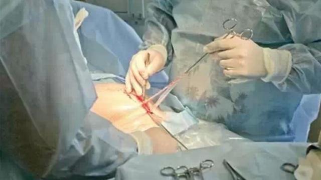 剖腹产产妇从产房出来有什么流程,刚剖腹产出来的小孩一惊一乍的