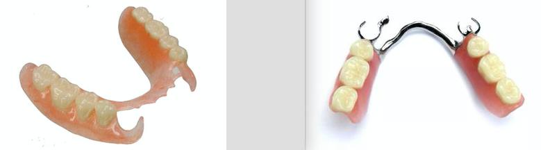 缺牙会引起口腔问题,缺牙怎么治疗不影响做核磁