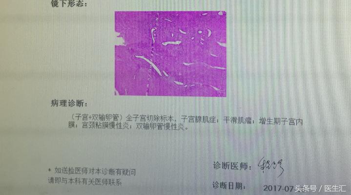 月经量多、阴道出血！小心子宫腺肌症！