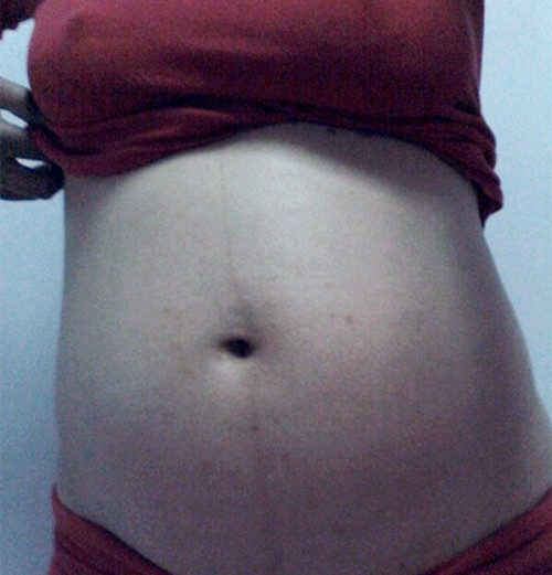 孕8周外阴瘙痒会导致见红吗,孕晚期见红以后外阴瘙痒