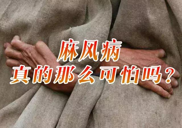 麻风病的症状和危害,麻风病可怕吗