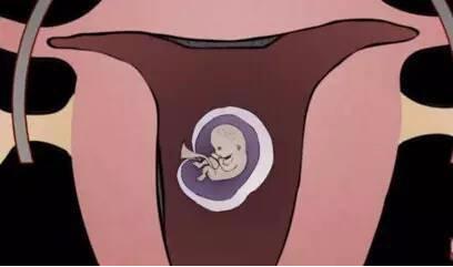 堕胎时人类是怎样一步步杀死自己孩子的?妈妈会看哭!