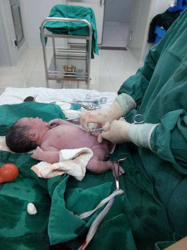 羊水偏少胎儿偏大能顺生吗,羊水偏少的胎儿