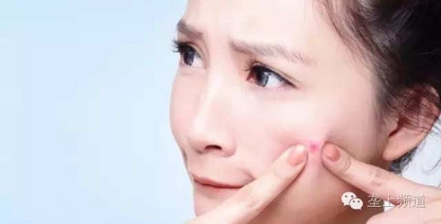 脸上长痘痘可以用醋洗脸吗,用醋洗面会长痘