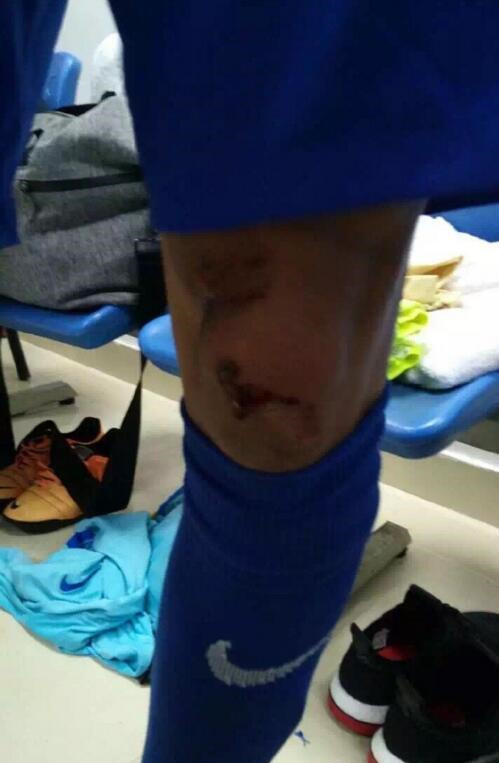 足协杯打架事件最新,足协杯打架