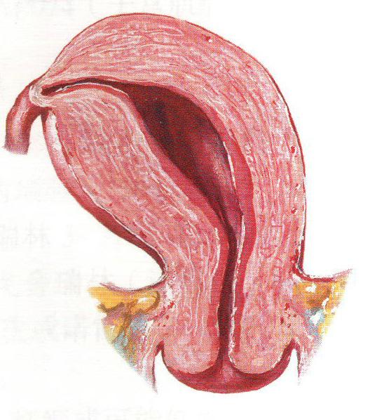 单角子宫对胎儿发育会有影响吗？