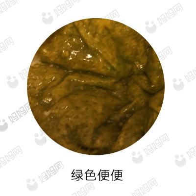 宝宝拉这几种便便要去医院,宝宝有问题的便便是怎样的