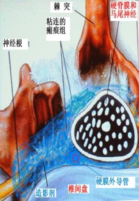 宣武医院头痛专家排名,宣武医院治疗头痛