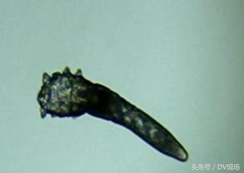 睫毛里竟住着虫子，吓死宝宝了！眼睛干痒的你一定要看看