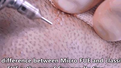 日本研究秃顶,日本教授秃头研究