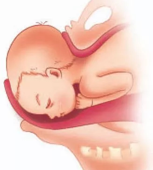 准妈妈必知分娩第二和第三产程