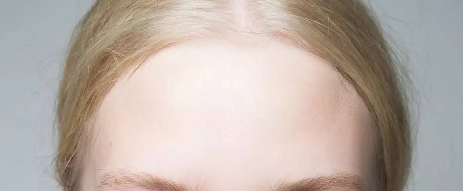 黑头一挤就缩回去,黑头挤了两三次会变大嘛