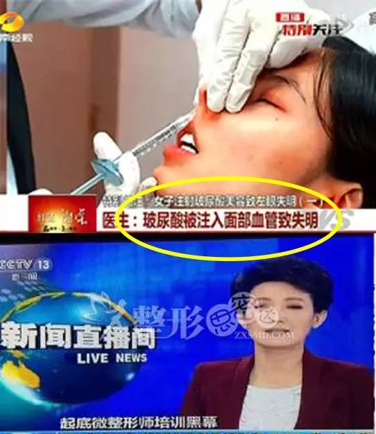 韩国微整假药，*证假**，假医院世界无法再爱了！