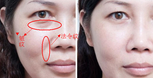 80%女生都不知道的敷面膜误区,别让脸敷烂了正确使用面膜的步骤