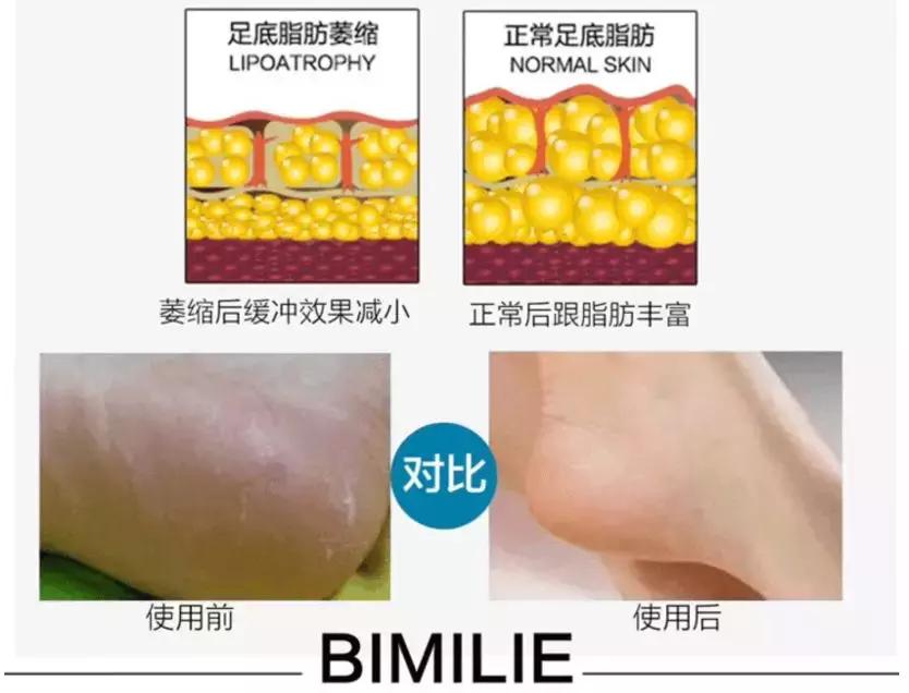 睡觉穿一只袜子,睡觉时穿一个袜子