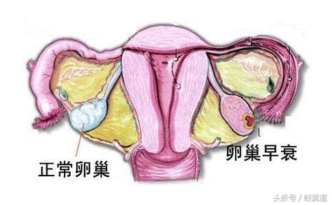 37岁女子3月没来月经，因1个部位早衰