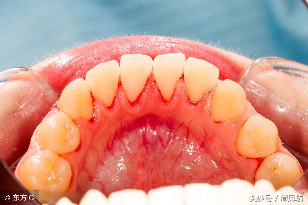 人体衰老是从什么时候开始的,人体衰老的十个步骤详细图解