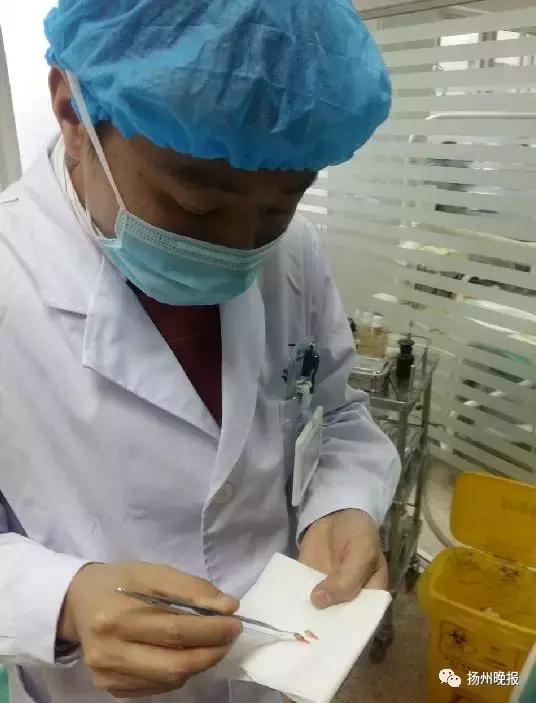 长出两排牙齿,6岁小孩并排长了两颗牙