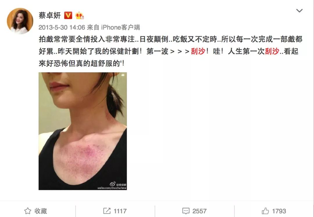 阿娇刮痧,阿娇刮痧养生视频