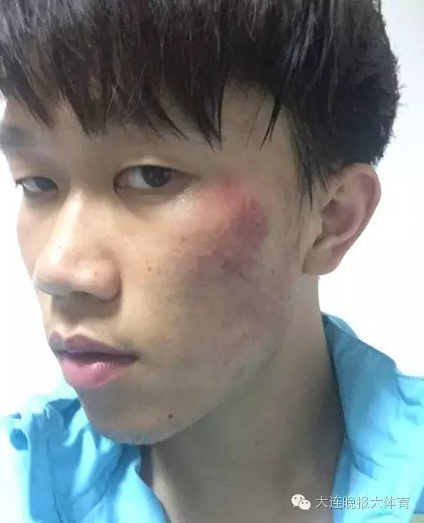 2016足协杯苏宁宏兴,武汉宏兴江苏苏宁打架