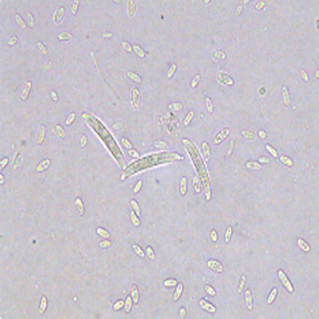 露天西瓜坐瓜期枯萎病怎么治疗,西瓜根施多菌灵能治枯萎病吗