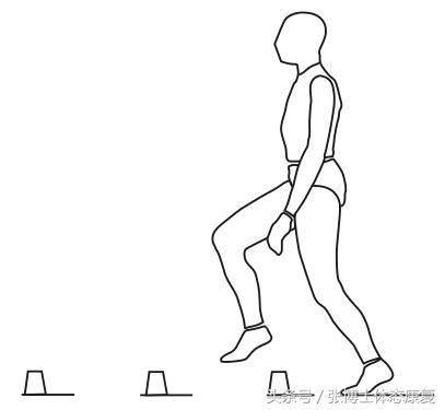 acl前交叉韧带重建康复,acl韧带重建